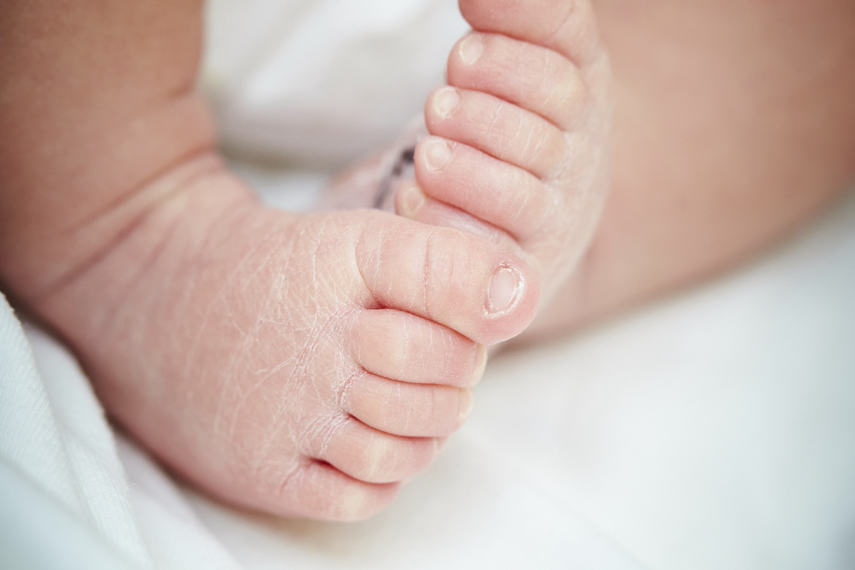 赤ちゃんは人生で一番乾燥肌になる時期だった 医者が教える 部屋の加湿が赤ちゃんの健康を守る理由 マイニチプラス 製品情報 ダイニチ工業株式会社 Dainichi