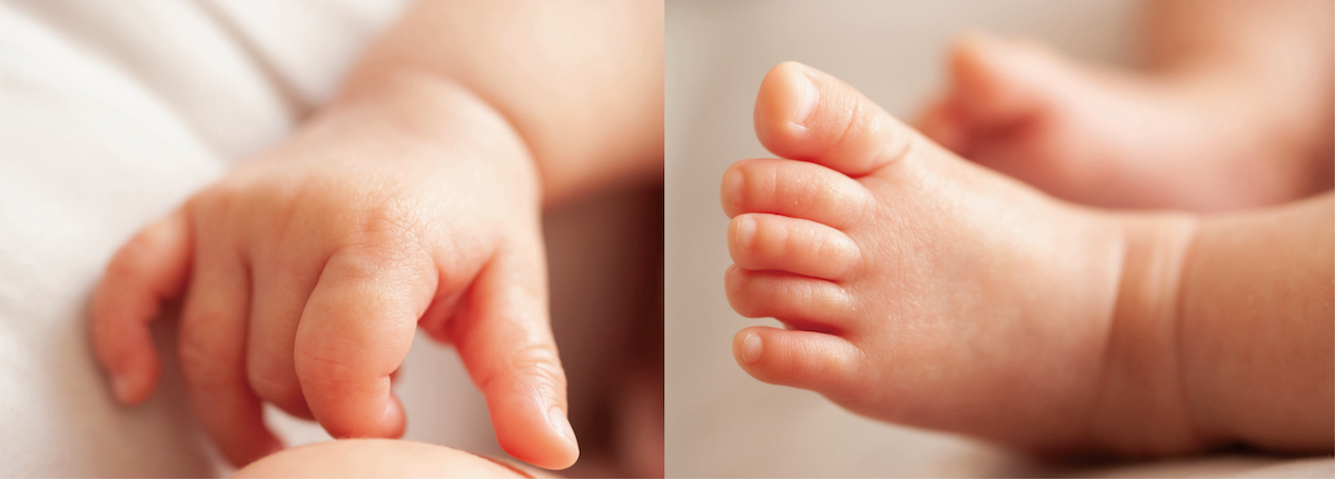 赤ちゃんは人生で一番乾燥肌になる時期だった 医者が教える 部屋の加湿が赤ちゃんの健康を守る理由 マイニチプラス 製品情報 ダイニチ工業株式会社 Dainichi