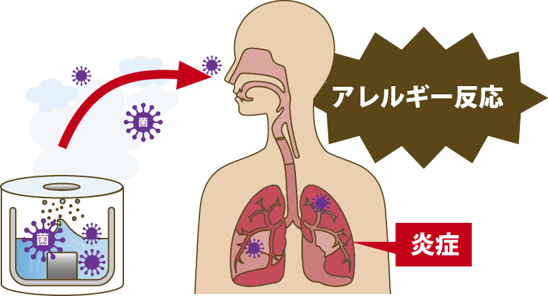 加湿器が招く「肺炎リスク」、正しい手入れ・使い方・しまい方とは | News&Analysis | ダイヤモンド・オンライン